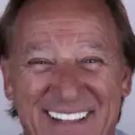 Close-up of a smiling mature man showing healthy teeth.