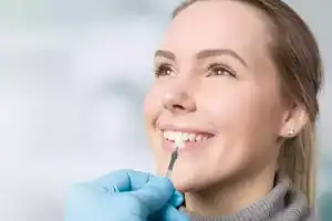 veneers maintenance