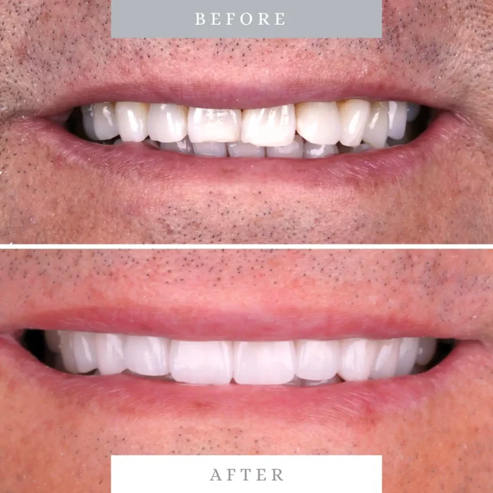 Caso 7 antes y despues