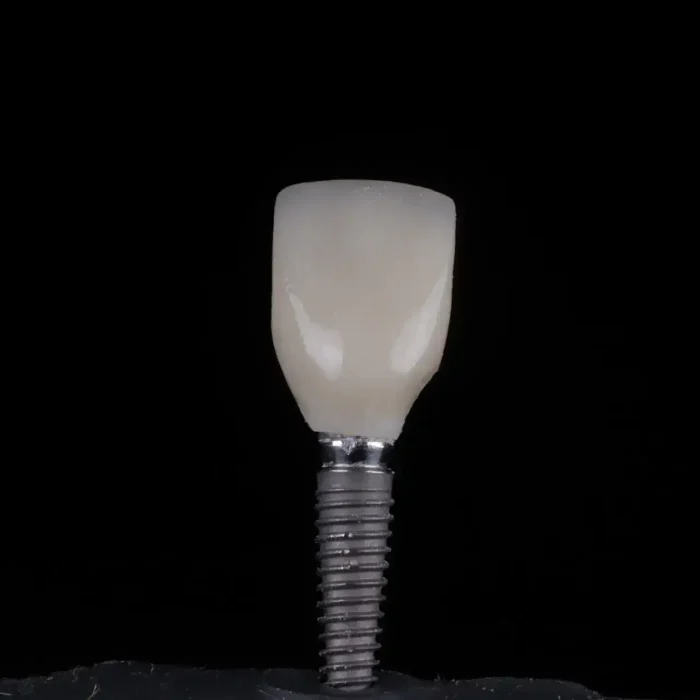 Dental Implant