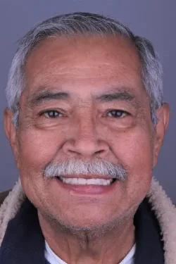 Close-up of friendly elderly man with bright smile, showing healthy teeth and confident expression.
